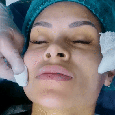 Limpieza facial Margiestetic